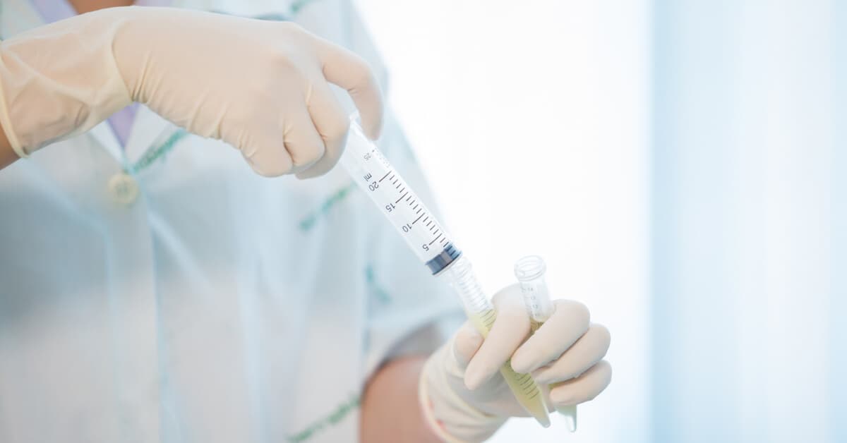Amniyosentez Testi Nedir ve Neden Yapılır? kapak resmi