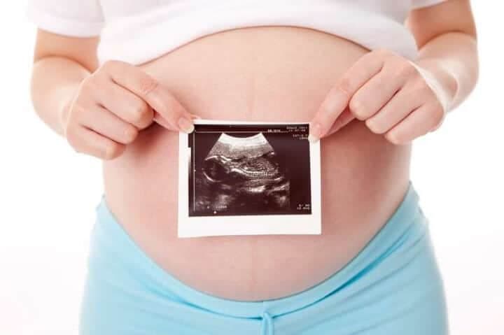 Ultrasonda Cinsiyet Tahmini Yanıltıcı Olabilir mi? kapak resmi