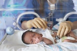 Prematüre Bebek