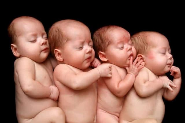 Tüp Bebek Tedavisinde Çoğul Gebelikler image