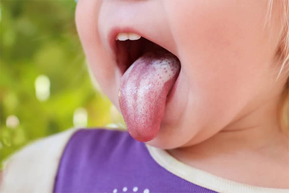 Bebekler Pamukçuk Olmaması İçin Yapılması Gerekenler! kapak resmi