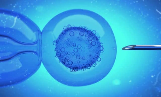 Mikroenjeksiyon Yöntemi Nedir? image