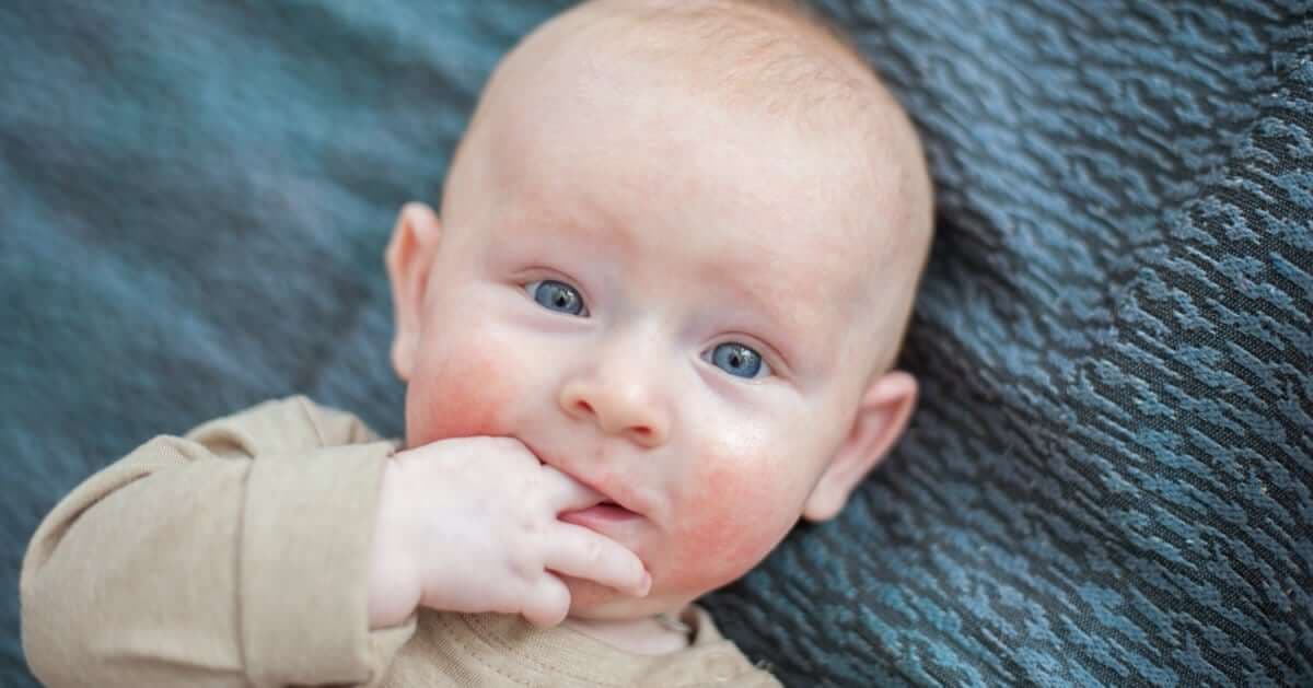 14 Eylül Dünya Atopik Dermatit Günü kapak resmi