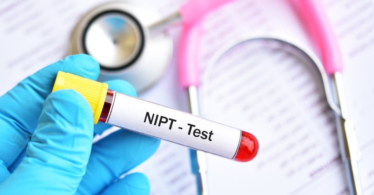 NIPT Testi Nedir? kapak resmi