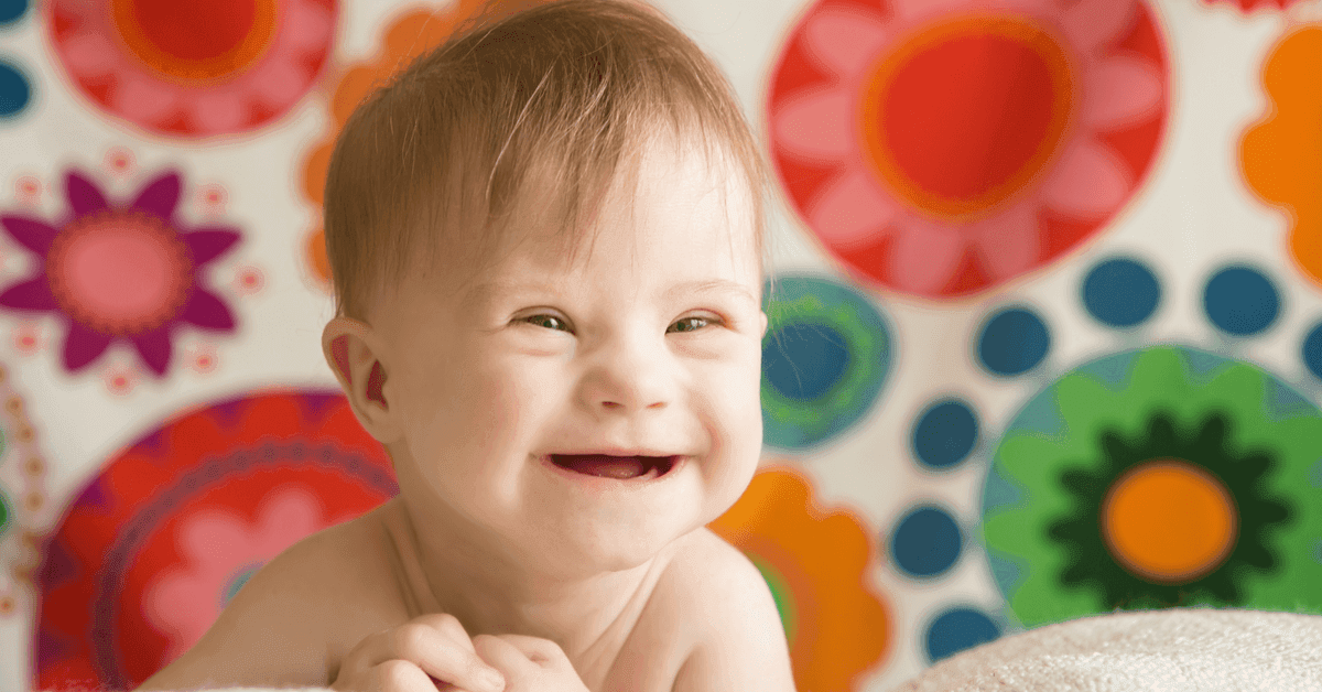 Down Sendromu Nedir? Down Sendromu Belirtileri Nelerdir?
