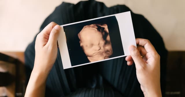 Ultrason Yöntemi Hakkında Tüm Detaylar image