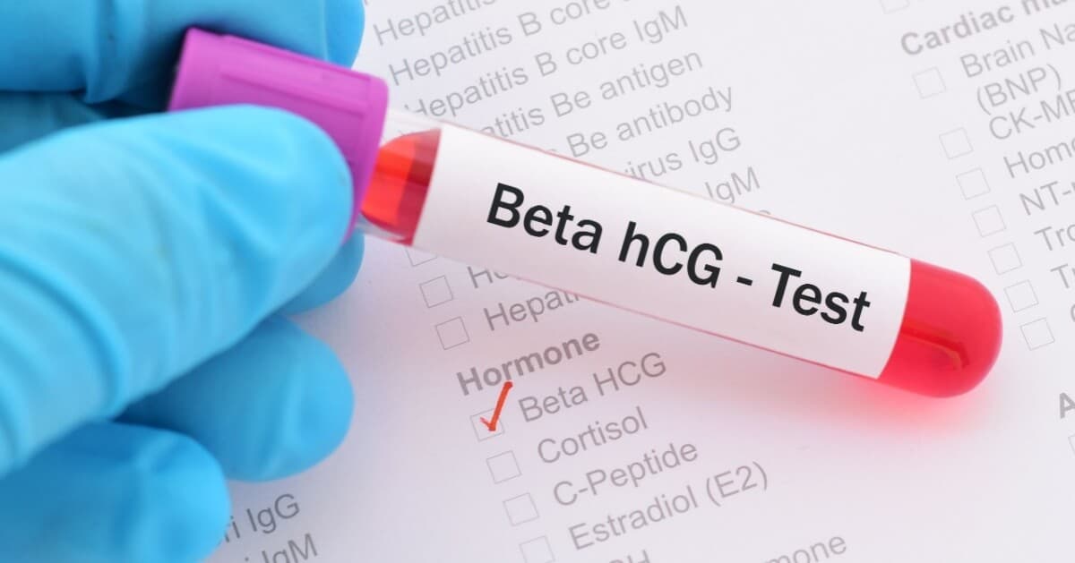 Beta HCG Nedir? kapak resmi