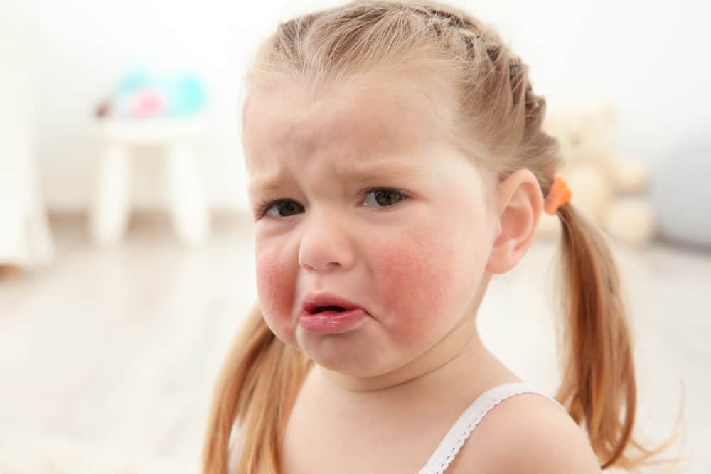 bebeklerde nevresim alerjisi ile ilgili görsel sonucu