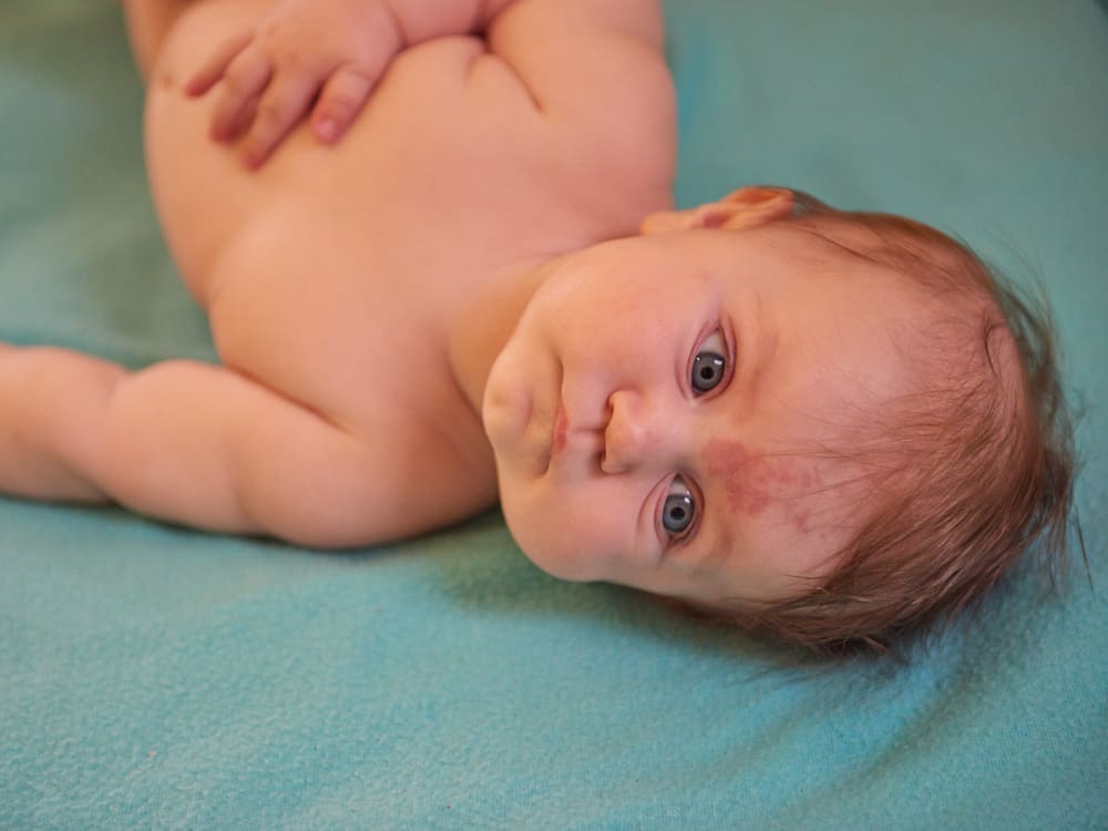 bebeklerde göz bebeğinde leke