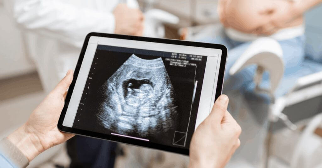 NST (NonStres Test) Sancı Testi