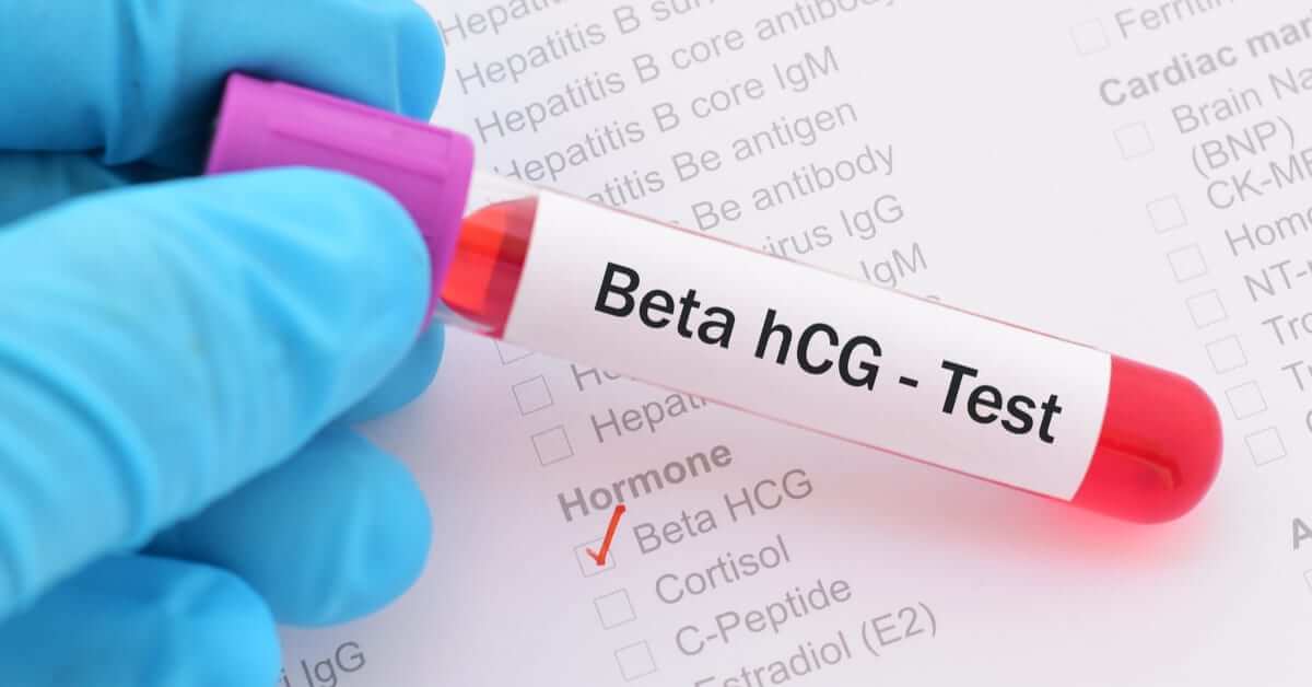 Düşük Beta Hcg ile Sağlıklı Gebelik Yaşanır mı?