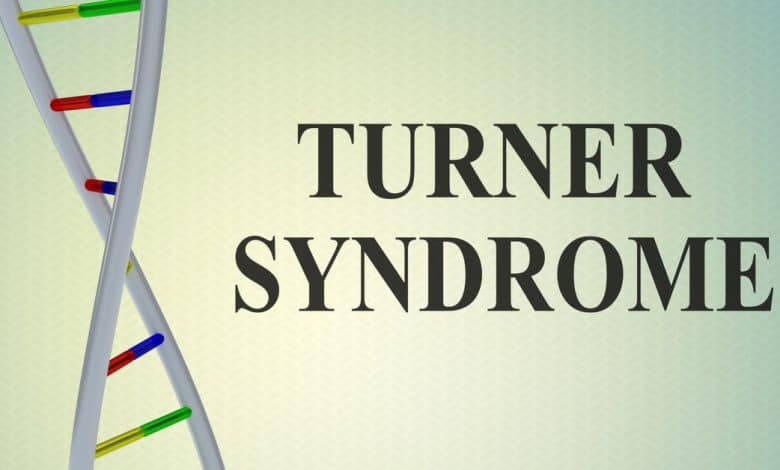 turner-sendromu