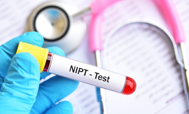 nipt-testi-nedir