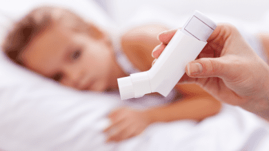 Bebeklerde Sivrisinek Isirigi Ne Iyi Gelir Nasil Gecer