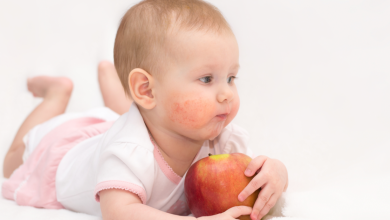 Alerjik Bebekler için Alternatif Besinler