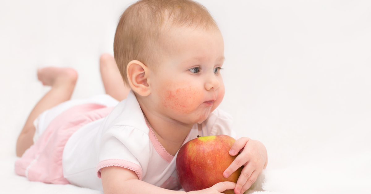 Alternative Foods for Allergic Babies 2 Alternative Foods for Allergic Babies